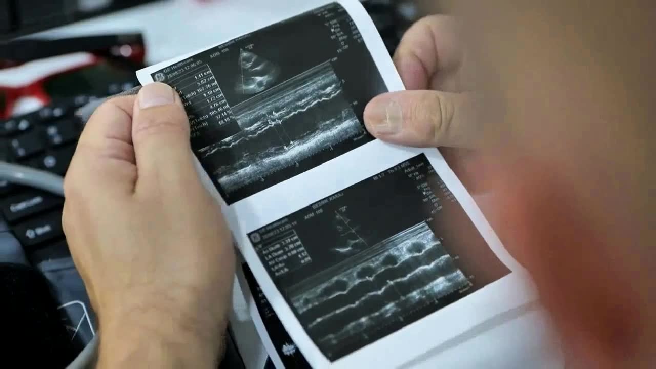 Echocardiography images