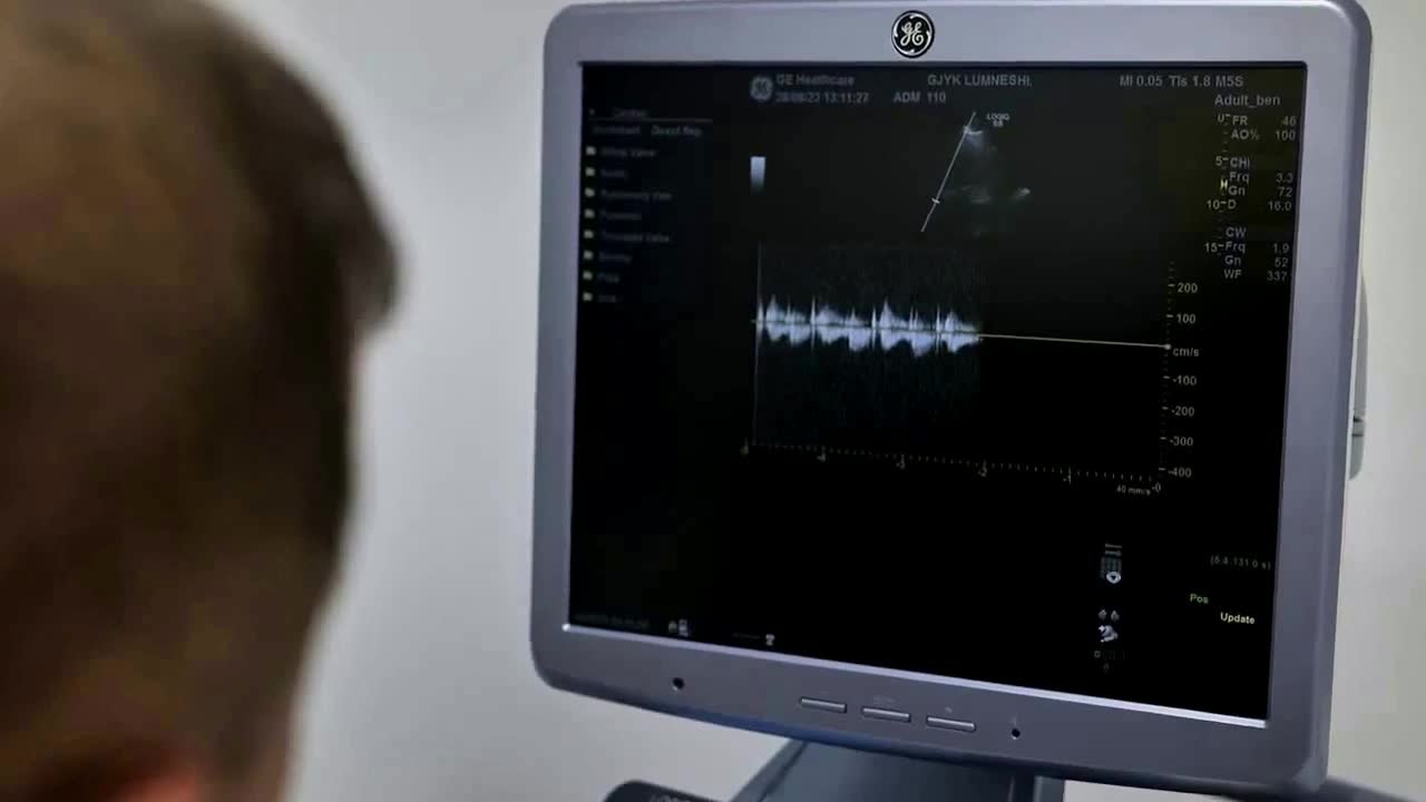 Doppler ultrasound exam